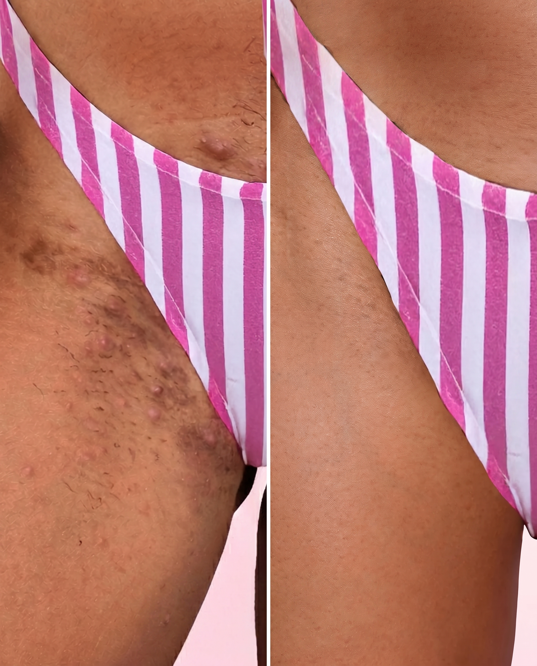 BELLA SKIN | Grand Oferta!